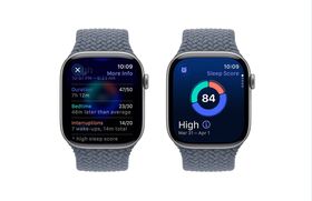 Apple Watch Series 11